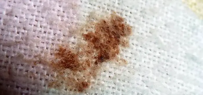 How-To-Remove-Dried-Blood-Stains-From-Upholstery-And-Clothes